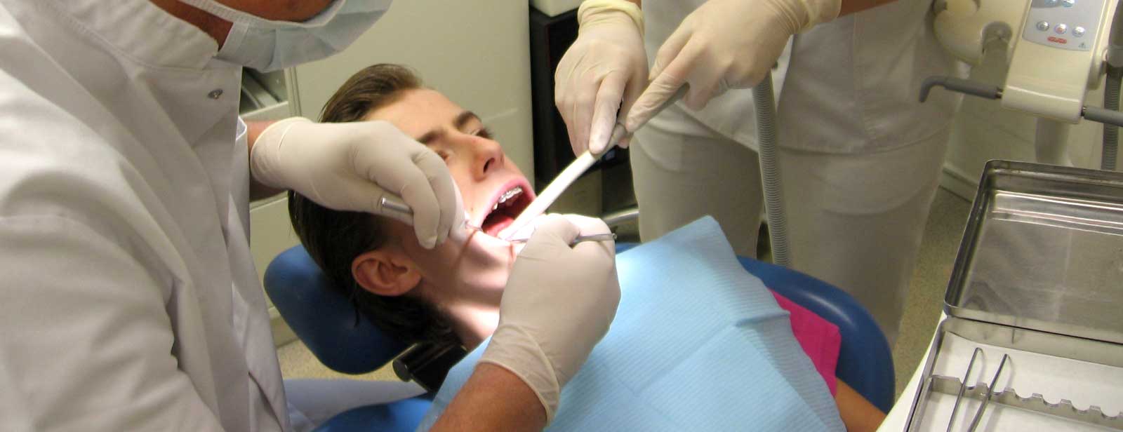 Tandplak en tandsteen verwijderen